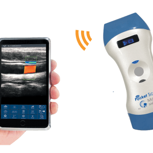 PocketScan Ultrasound System