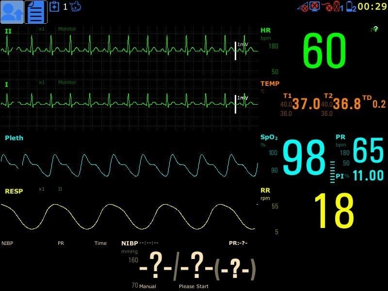 VitalSurv multiparameter monitoring - Image 2